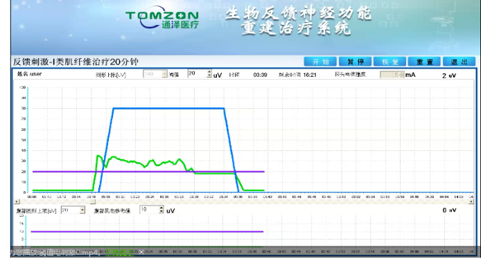 盆底康復(fù)治療怎么做？盆底康復(fù)治療肌電生物反饋治療儀的機(jī)理是什么？