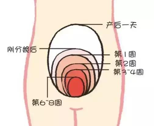 產(chǎn)后康復(fù)，什么叫子宮復(fù)舊不良？