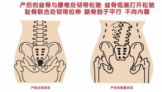 自從知道產后康復治療儀后，再也不怕腹直肌修復了