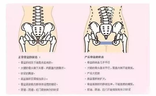 產(chǎn)后修復(fù)治療儀器對(duì)于腹直肌修復(fù)有效果嗎？