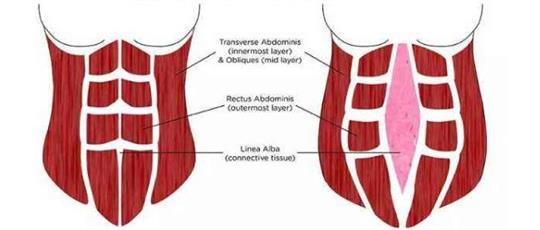 熱門話題之產(chǎn)后腹直肌分離如何康復(fù)，腹直肌修復(fù)儀器功不可沒