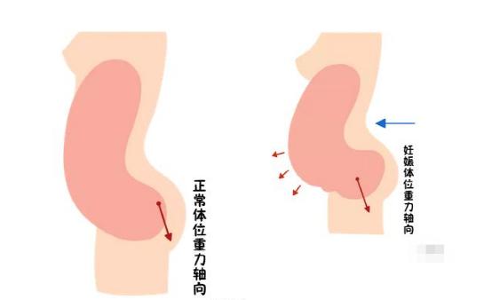 盆底恢復(fù)是否可以使用儀器？