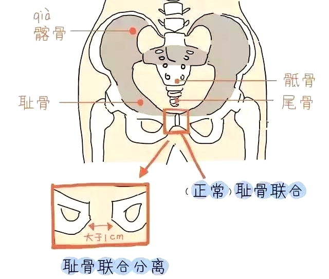 盆底康復訓練