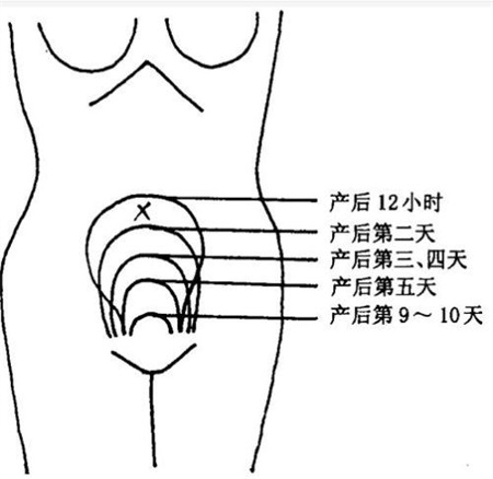 產(chǎn)后康復