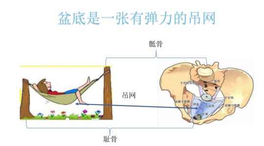 盆底肌修復(fù).JPG