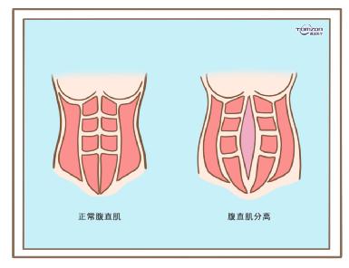 盆底肌修復(fù)儀器